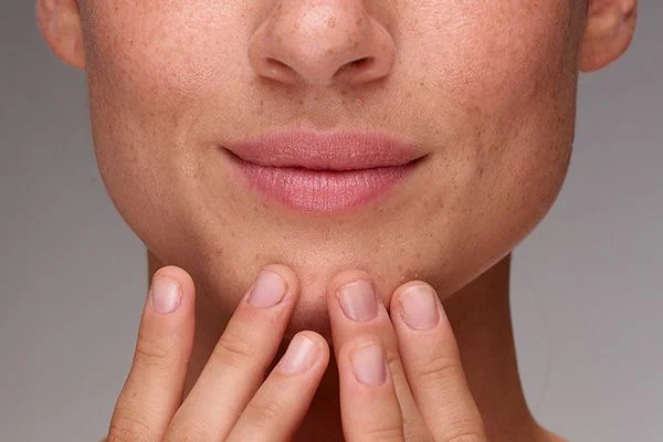 Annoying Skin Problems That Most People Have To Face