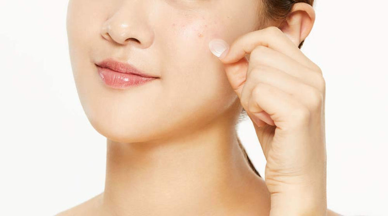 Acne Patches: How Do They Work?