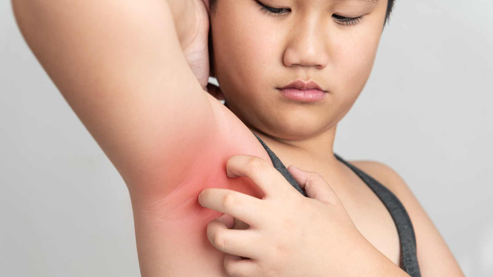 Itchy Armpits: Reasons and Treatments for This Skin Condition
