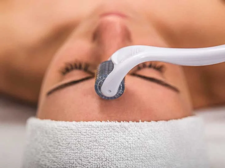 How to Care for Your Skin After a Microneedling Session?